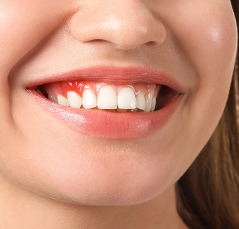 Close-up of a woman’s smile.